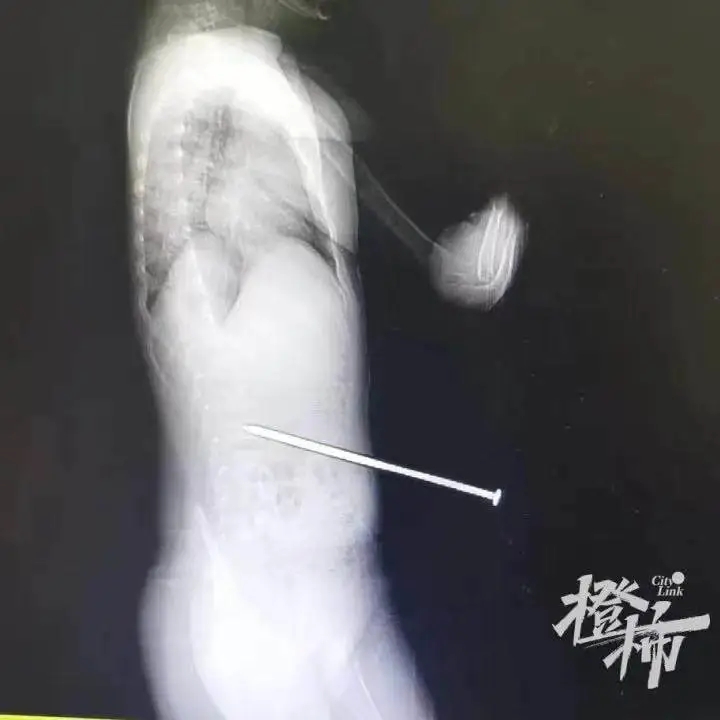 罐取暖使用不当身亡露营小心这些安全隐患pg电子试玩入口新闻多一度丨露营者瓦斯(图5)